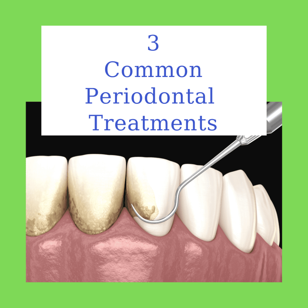 Common Periodontal Treatments Tulsa Precision Dental