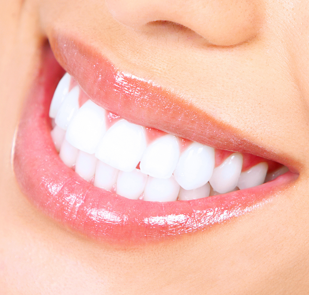 Teeth Whitening - Tulsa, OK - Tulsa Precision Dental