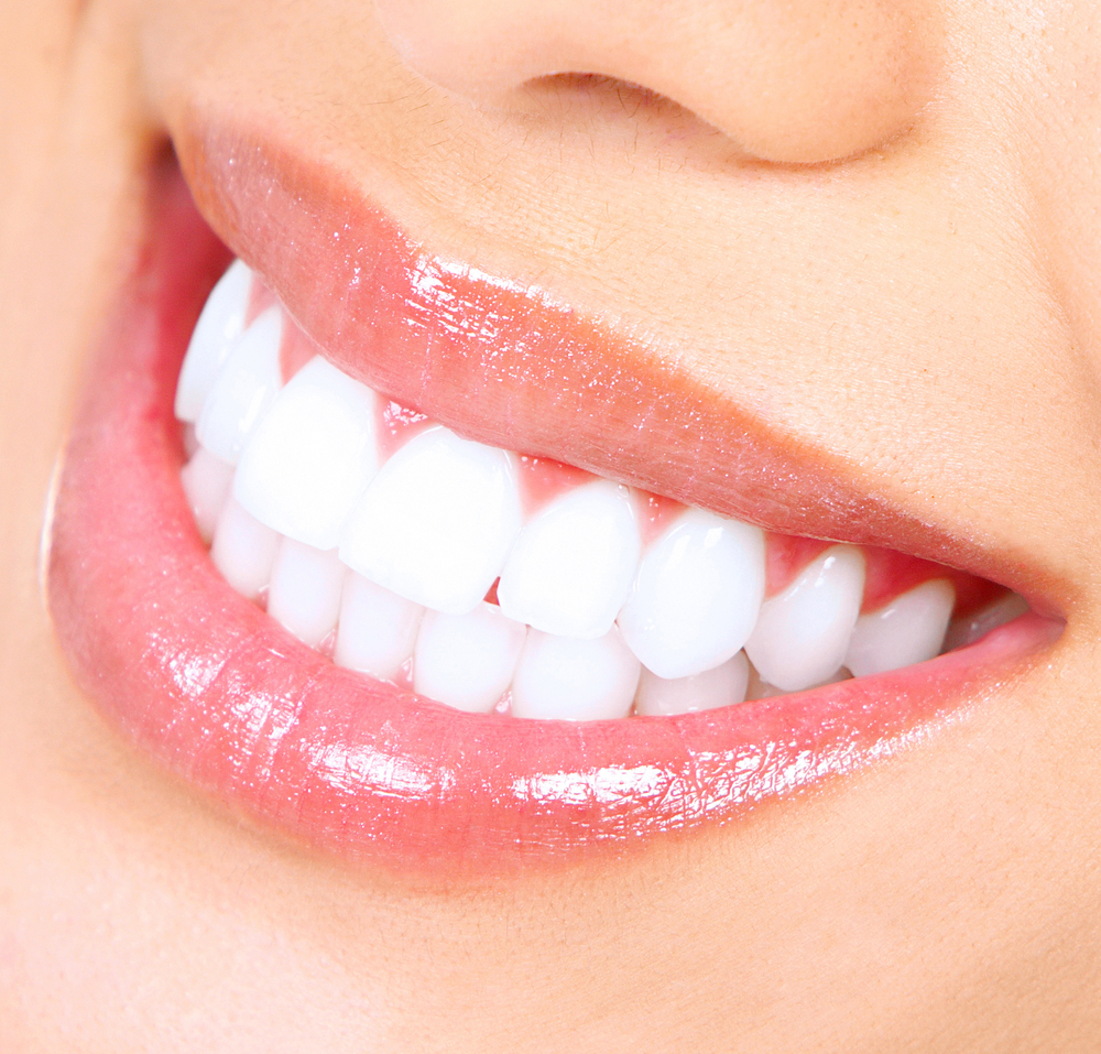 Best teeth whitening for home use