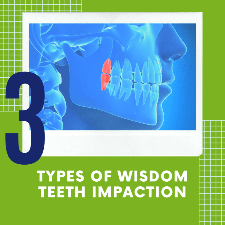 title banner for "3 types of wisdom teeth extraction"