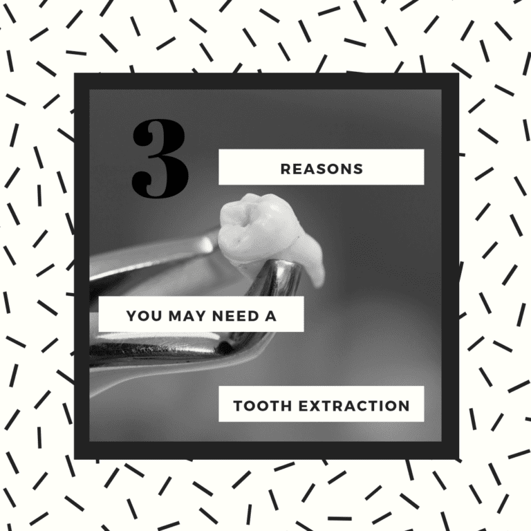 title banner for "3 reasons you may need a tooth extraction"