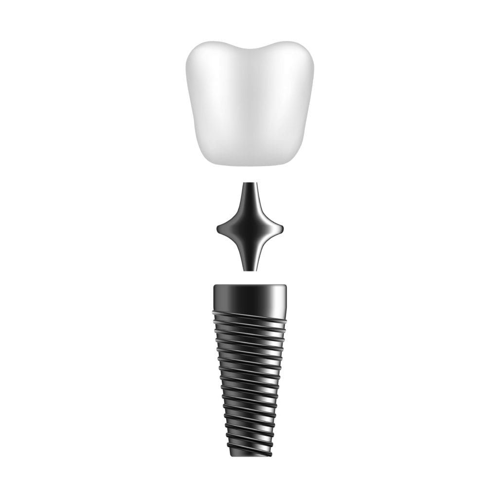 Implant-supported crown