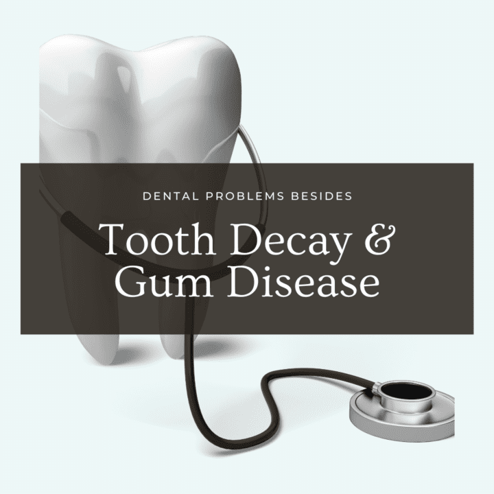 Dental Problems Besides Tooth Decay And Gum Disease Tulsa Precision Dental