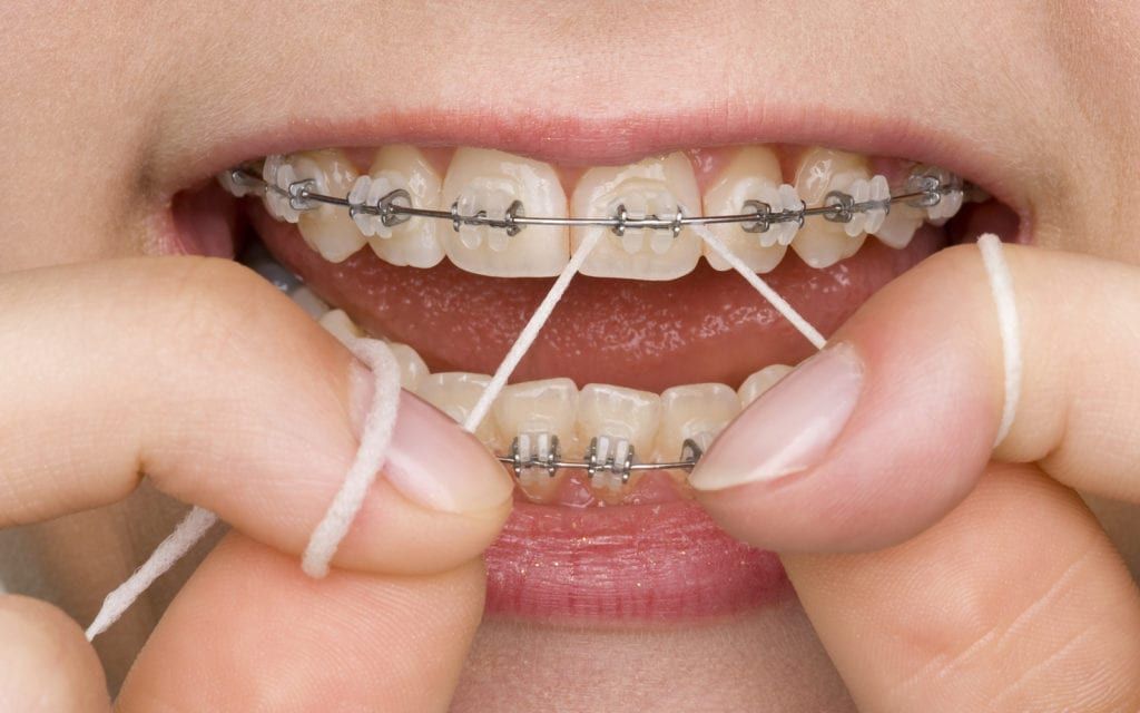 Woman with braces flossing and smiling