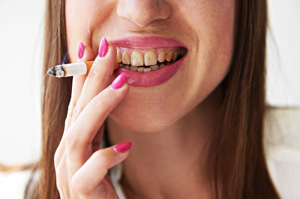 woman smoking with stained teeth
