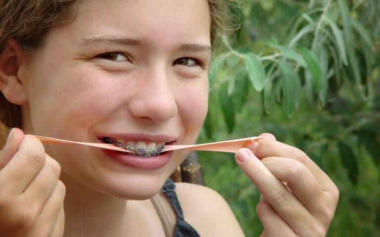 Girl with braces chewing gum